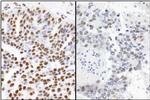 53BP1 Antibody in Immunohistochemistry (Paraffin) (IHC (P))