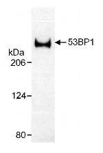 53BP1 Antibody in Western Blot (WB)