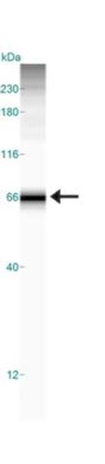 Carbonic Anhydrase IX Antibody in Western Blot (WB)