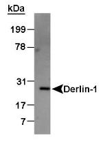 DERL1 Antibody in Western Blot (WB)