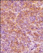 HIF1A Antibody in Immunohistochemistry (Paraffin) (IHC (P))