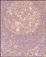 CTGF Antibody in Immunohistochemistry (Paraffin) (IHC (P))