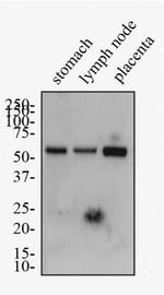 LYVE1 Antibody in Western Blot (WB)