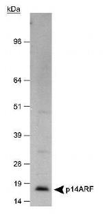 p14ARF Antibody in Western Blot (WB)