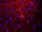 NEFM Antibody in Immunocytochemistry (ICC/IF)