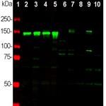 NEFM Antibody in Western Blot (WB)