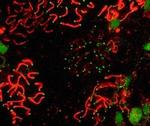 SCP1 Antibody in Immunocytochemistry (ICC/IF)