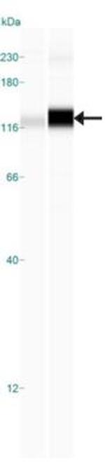 SCP1 Antibody in Western Blot (WB)