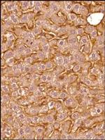 SR-BI Antibody in Immunohistochemistry (Paraffin) (IHC (P))