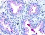 ABCA1 Antibody in Immunohistochemistry (Paraffin) (IHC (P))