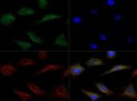 LIPG Antibody in Immunocytochemistry (ICC/IF)