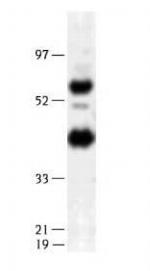 LIPG Antibody in Western Blot (WB)