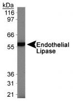 LIPG Antibody in Western Blot (WB)