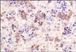 ChREBP Antibody in Immunohistochemistry (Paraffin) (IHC (P))