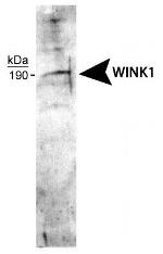 WNK1 Antibody in Western Blot (WB)