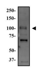 WNK4 Antibody in Western Blot (WB)