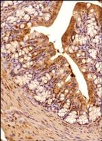 IRE1 alpha Antibody in Immunohistochemistry (Paraffin) (IHC (P))