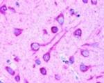 LC3B Antibody in Immunohistochemistry (Paraffin) (IHC (P))