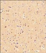 LC3B Antibody in Immunohistochemistry (Paraffin) (IHC (P))