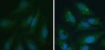 LC3A/LC3B Antibody in Immunocytochemistry (ICC/IF)