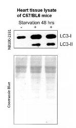 LC3A/LC3B Antibody in Western Blot (WB)