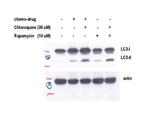 LC3A/LC3B Antibody in Western Blot (WB)