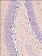 OCT4 Antibody in Immunohistochemistry (Paraffin) (IHC (P))