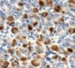 LOX Antibody in Immunohistochemistry (Paraffin) (IHC (P))