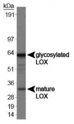 LOX Antibody in Western Blot (WB)