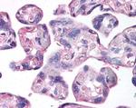 LOX Antibody in Immunohistochemistry (Paraffin) (IHC (P))