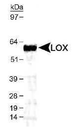 LOX Antibody in Western Blot (WB)