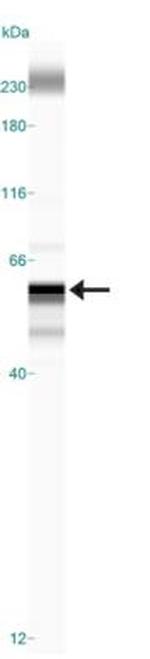 LOX Antibody in Western Blot (WB)