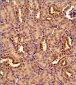 DNM1L Antibody in Immunohistochemistry (Paraffin) (IHC (P))