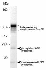 LOX Antibody in Western Blot (WB)