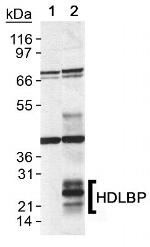 GPIHBP1 Antibody in Western Blot (WB)