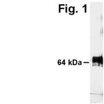 ADAMTS5 Antibody in Western Blot (WB)