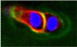 ADAMTS5 Antibody in Immunocytochemistry (ICC/IF)