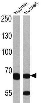 ADAMTS5 Antibody in Western Blot (WB)