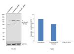 NFkB p65 Antibody in Western Blot (WB)