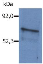 BLNK Antibody in Western Blot (WB)