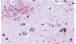 MAS1 Antibody in Immunohistochemistry (Paraffin) (IHC (P))