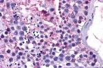 MAS1 Antibody in Immunohistochemistry (Paraffin) (IHC (P))