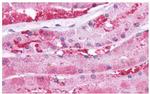 PTH1R Antibody in Immunohistochemistry (Paraffin) (IHC (P))