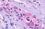 Prokineticin Receptor 1 Antibody in Immunohistochemistry (Paraffin) (IHC (P))