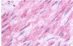 HTR1B Antibody in Immunohistochemistry (Paraffin) (IHC (P))