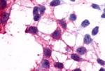 P2Y12 Antibody in Immunocytochemistry (ICC/IF)