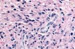 P2Y12 Antibody in Immunohistochemistry (Paraffin) (IHC (P))