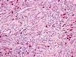 PTAFR Antibody in Immunohistochemistry (Paraffin) (IHC (P))