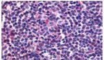 EDG6 Antibody in Immunohistochemistry (Paraffin) (IHC (P))