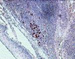 IL-22 Receptor alpha Antibody in Immunohistochemistry (IHC)